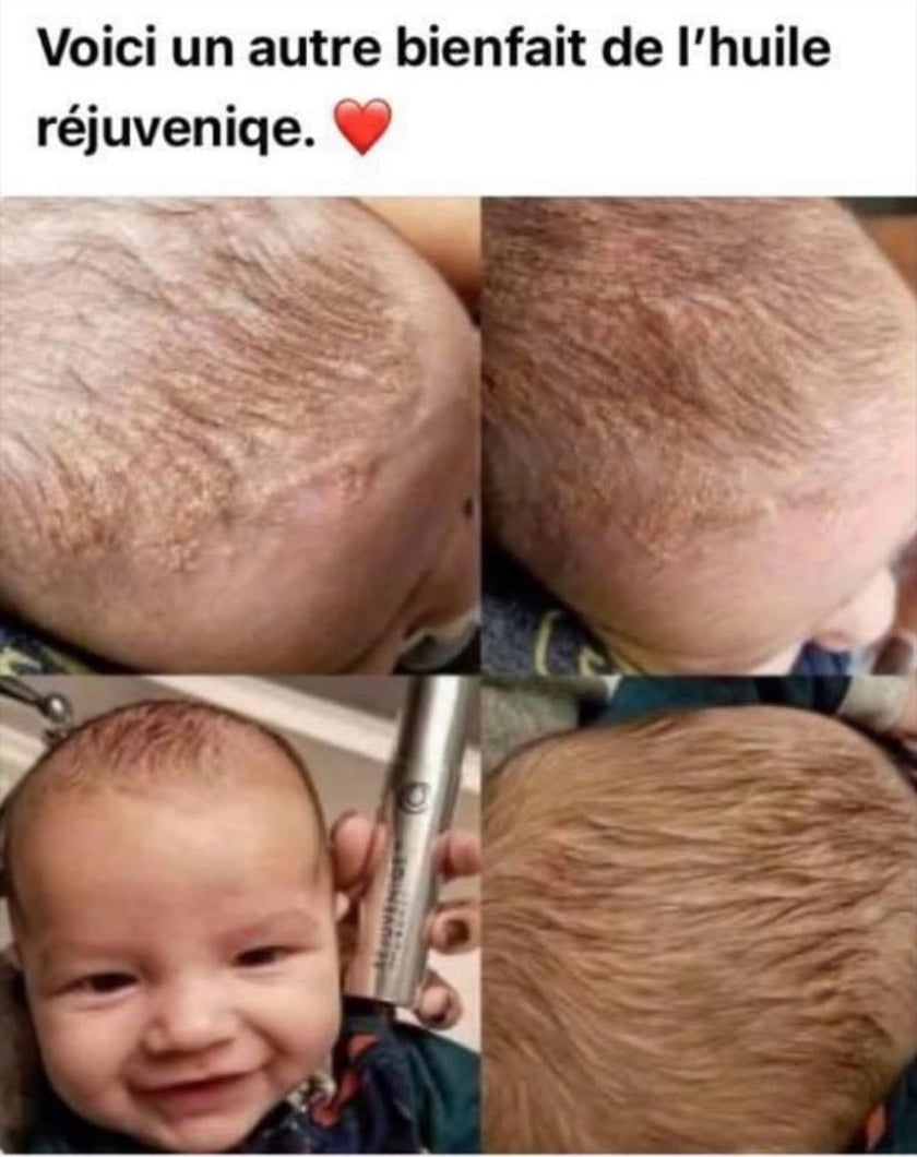 Rejuveniqe