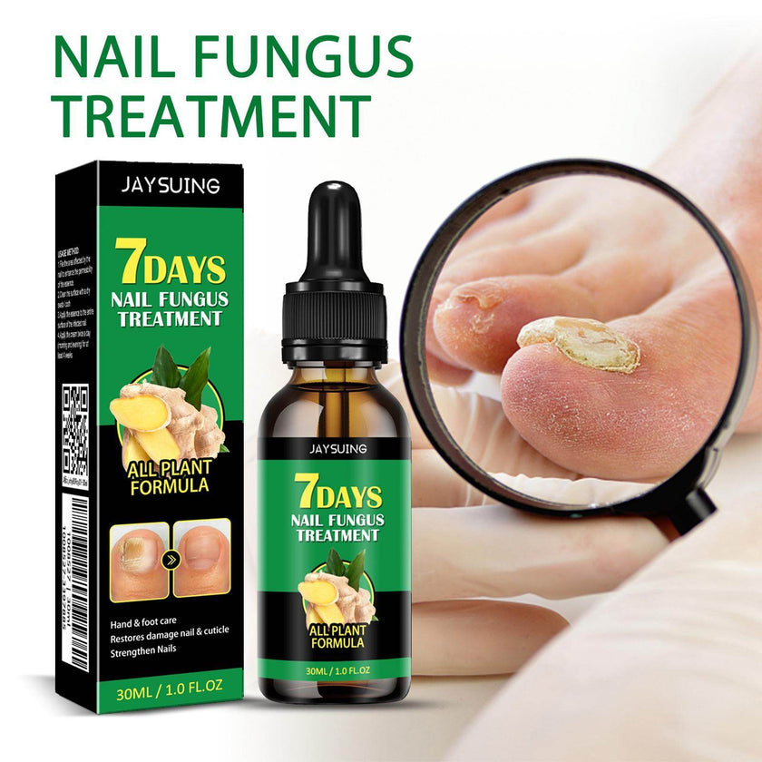 Jiasuying Ginger Nail Care Liquid, Repairs And Moisturizes Hand And Foot Nails, Makes Nails Shiny And Soft, And Improves Onychomycosis