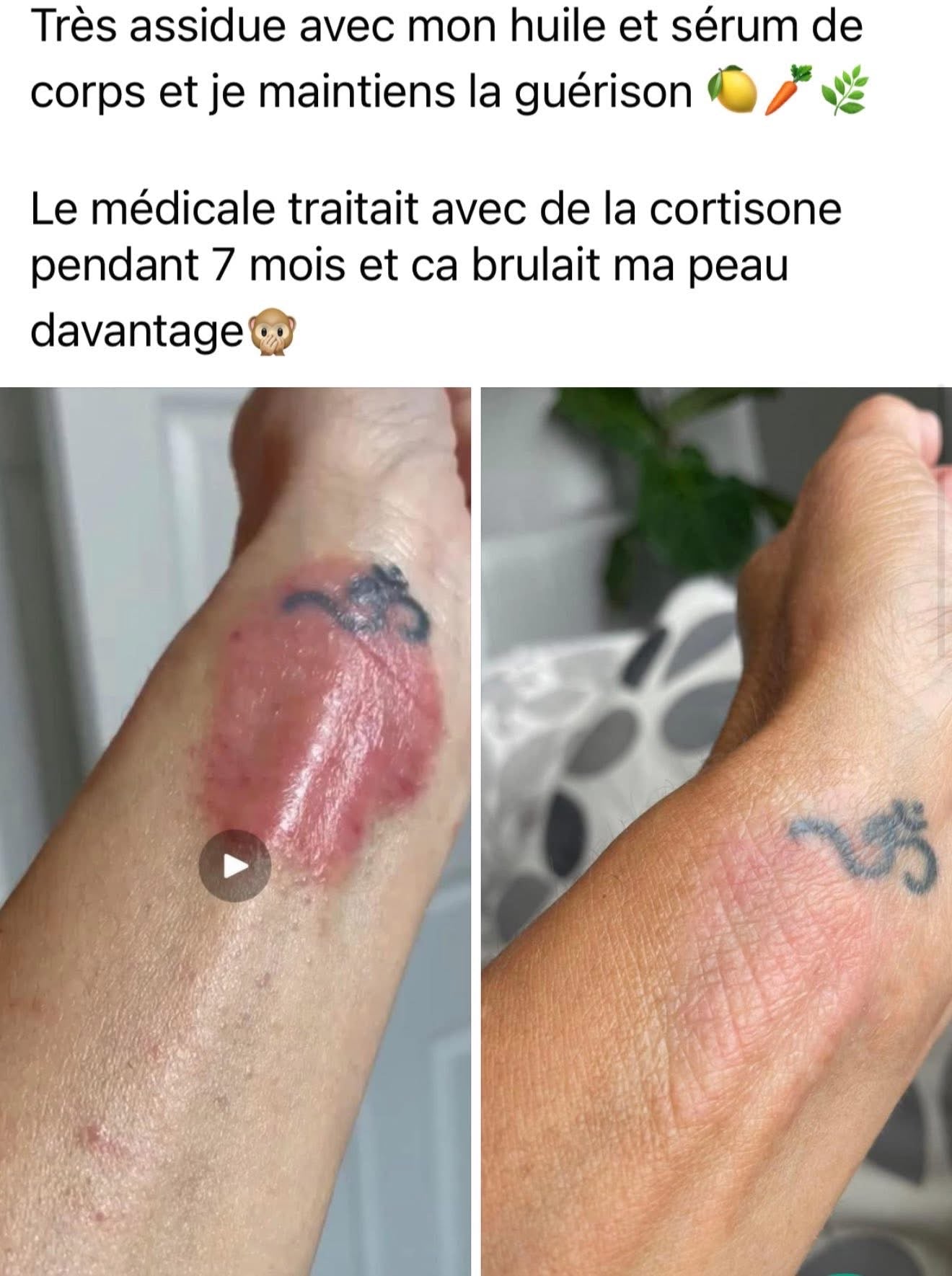 Rejuveniqe
