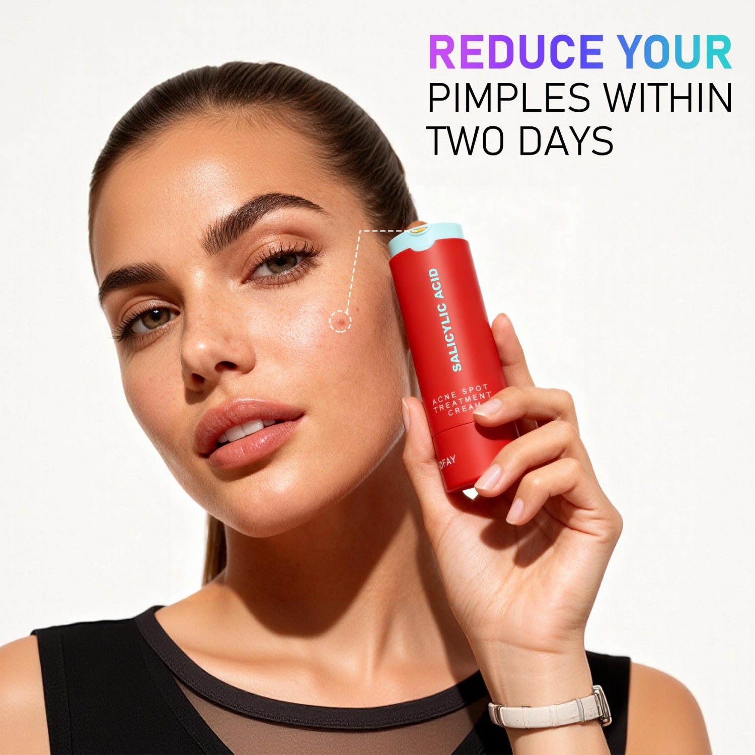 Acne Removing Lotion – Targeted Blemish Control & Skin Clarifying Treatment