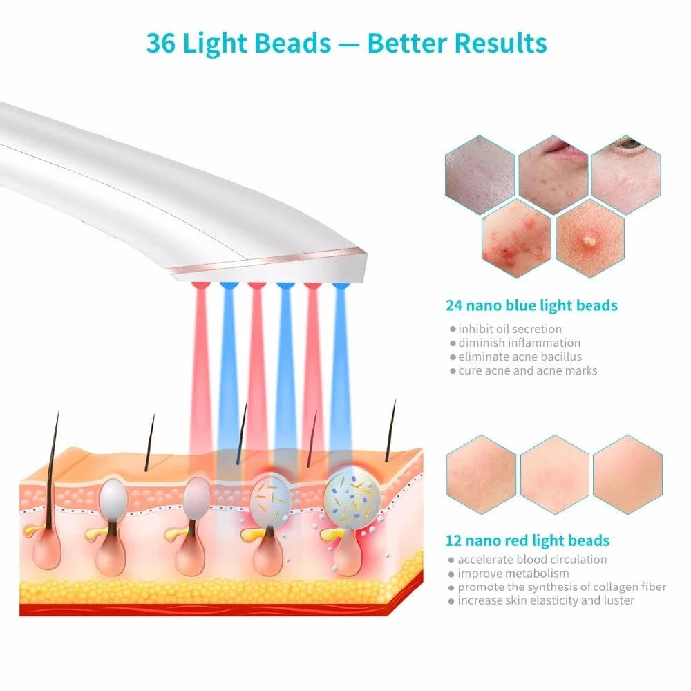 Xpreen Wireless Rechargeable Acne Light Therapy Device Blue & Red Light Acne Eraser