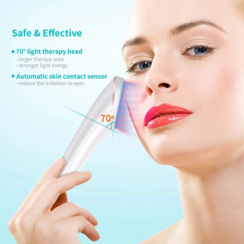 Xpreen Wireless Rechargeable Acne Light Therapy Device Blue & Red Light Acne Eraser