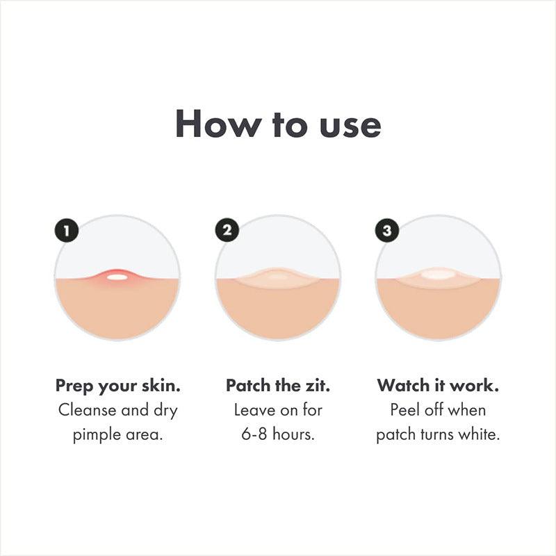 Hydrocolloid Acne Pimple Patches – Invisible Blemish Spot Treatment for Fast Healing