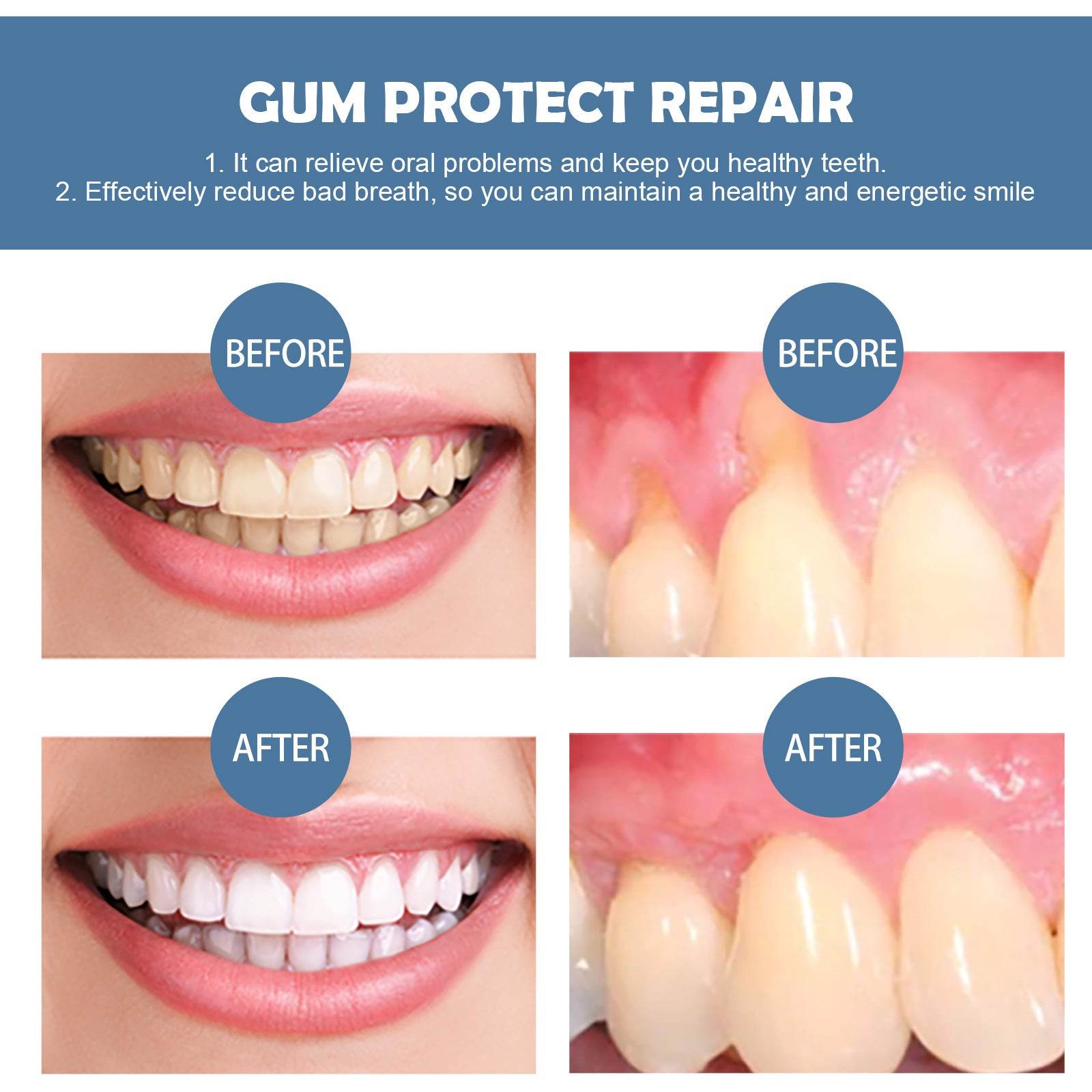 EELHOE Gum Repair Series Cleaning Oral Care