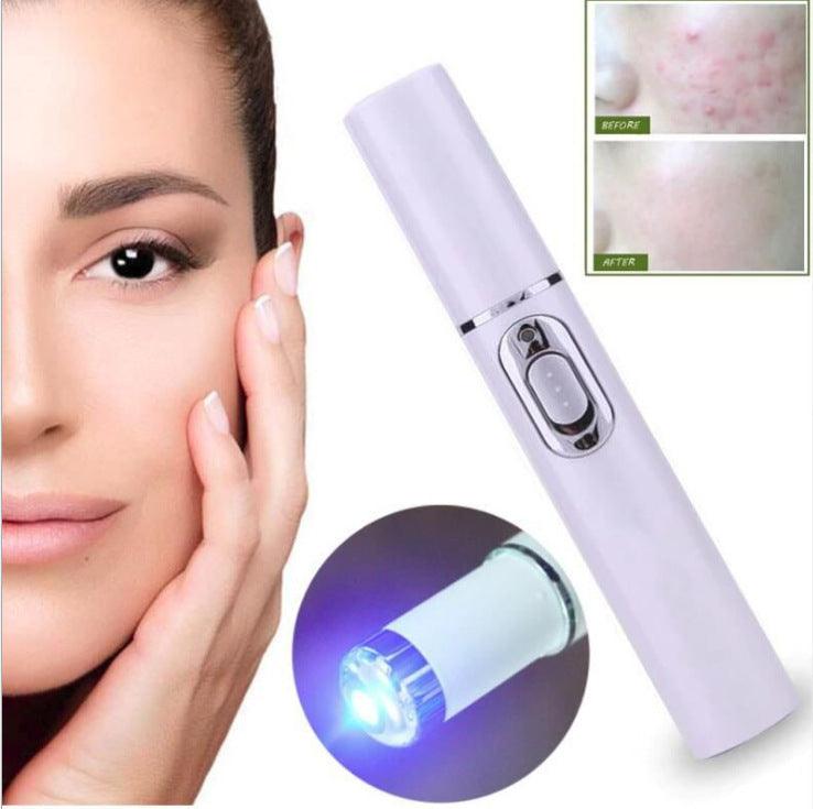 Blue Light Acne Laser Pen Wrinkle Removal Scar Dark Circle Remover Device