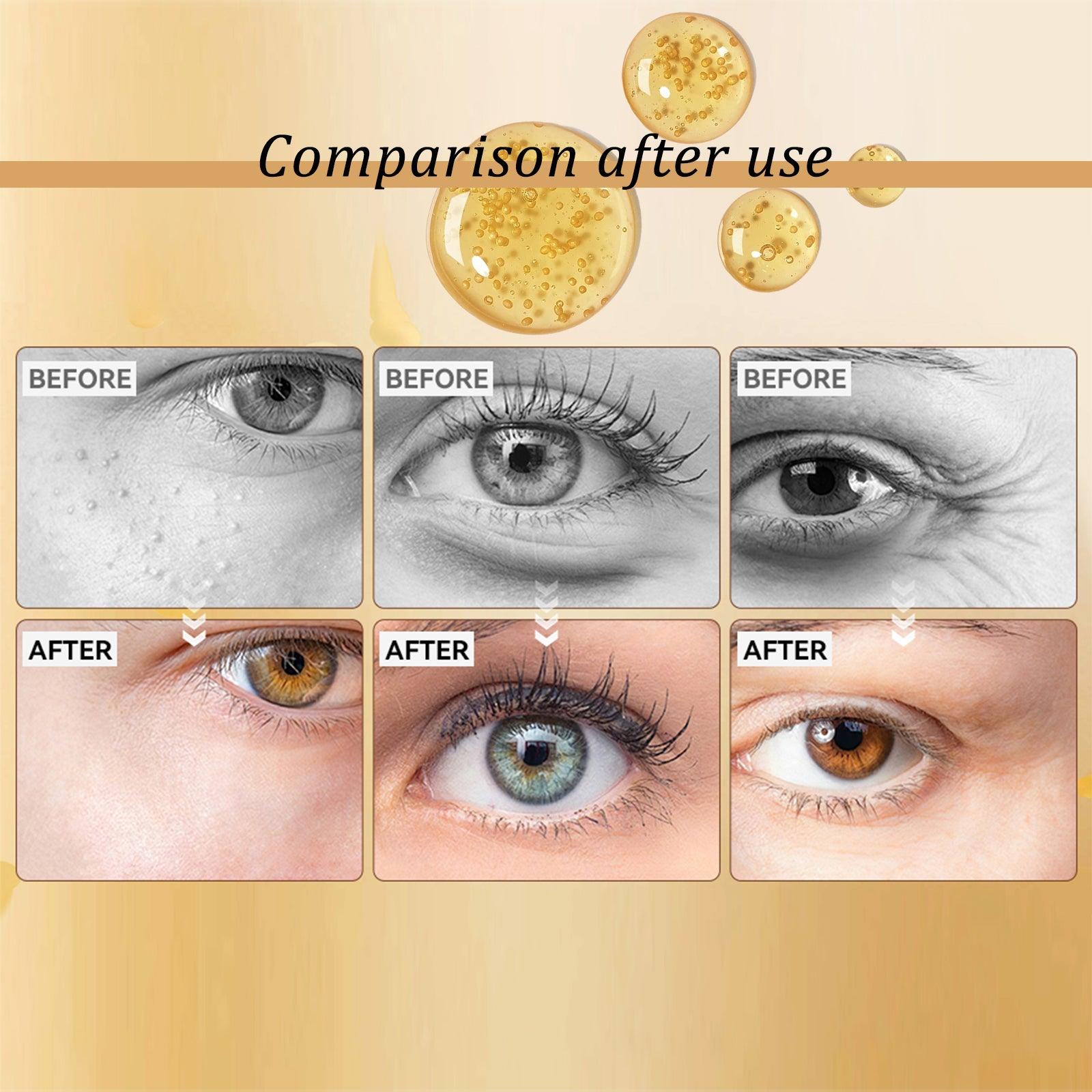 Snail Peptide Eye Cream with Roller Massager Hyaluronic Acid Collagen Puffiness Fine Lines Dark Circles