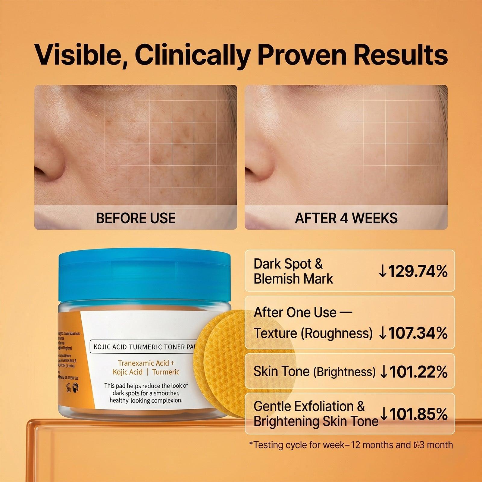 Kojic Acid Turmeric Toner Pads Exfoliating Facial Cotton Pads Brightening Dark Spot