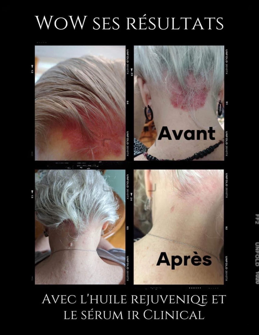 Rejuveniqe