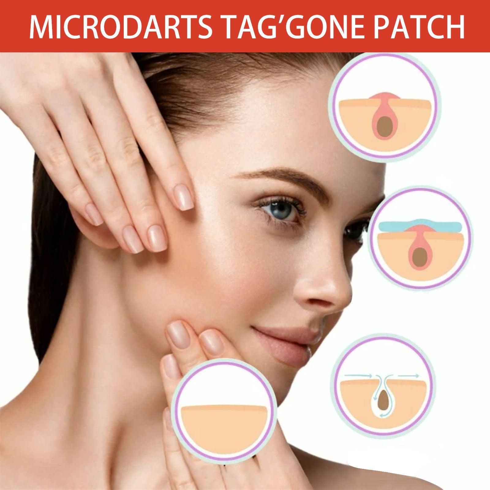 Micro Dart Skin Tag Remover Patches – Invisible Wart & Blemish Spot Treatment