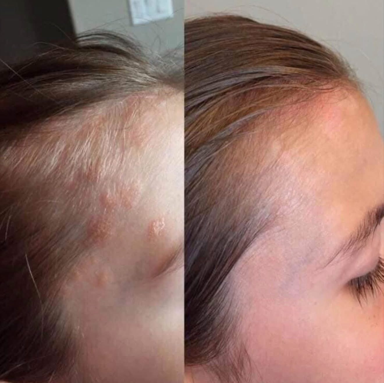 Rejuveniqe