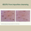 PYUNKANG YUL Calming Low pH Foaming Cleanser - Natural Centella Asiatica Moisturizing Daily Face Wash for Women and Men - Hyaluronic Facial Cleanser for Sensitive Skin - AHA Tea Tree Cica - 5.1 Fl. Oz 🍁 All In One Marketplace Canada
