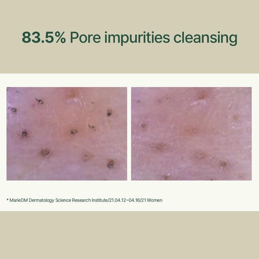 PYUNKANG YUL Calming Low pH Foaming Cleanser - Natural Centella Asiatica Moisturizing Daily Face Wash for Women and Men - Hyaluronic Facial Cleanser for Sensitive Skin - AHA Tea Tree Cica - 5.1 Fl. Oz 🍁 All In One Marketplace Canada