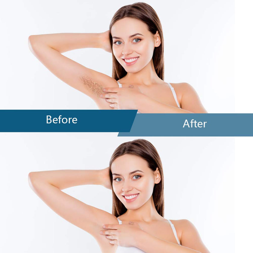 Bestidy Wax Beads, Waxing beans for Hair Removal, Women Men, Home Waxing for All Body and Brazilian Bikini Areas (Blue-1000g) 🍁 All In One Marketplace Canada