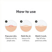 Hydrocolloid Acne Pimple Patches – Invisible Blemish Spot Treatment for Fast Healing