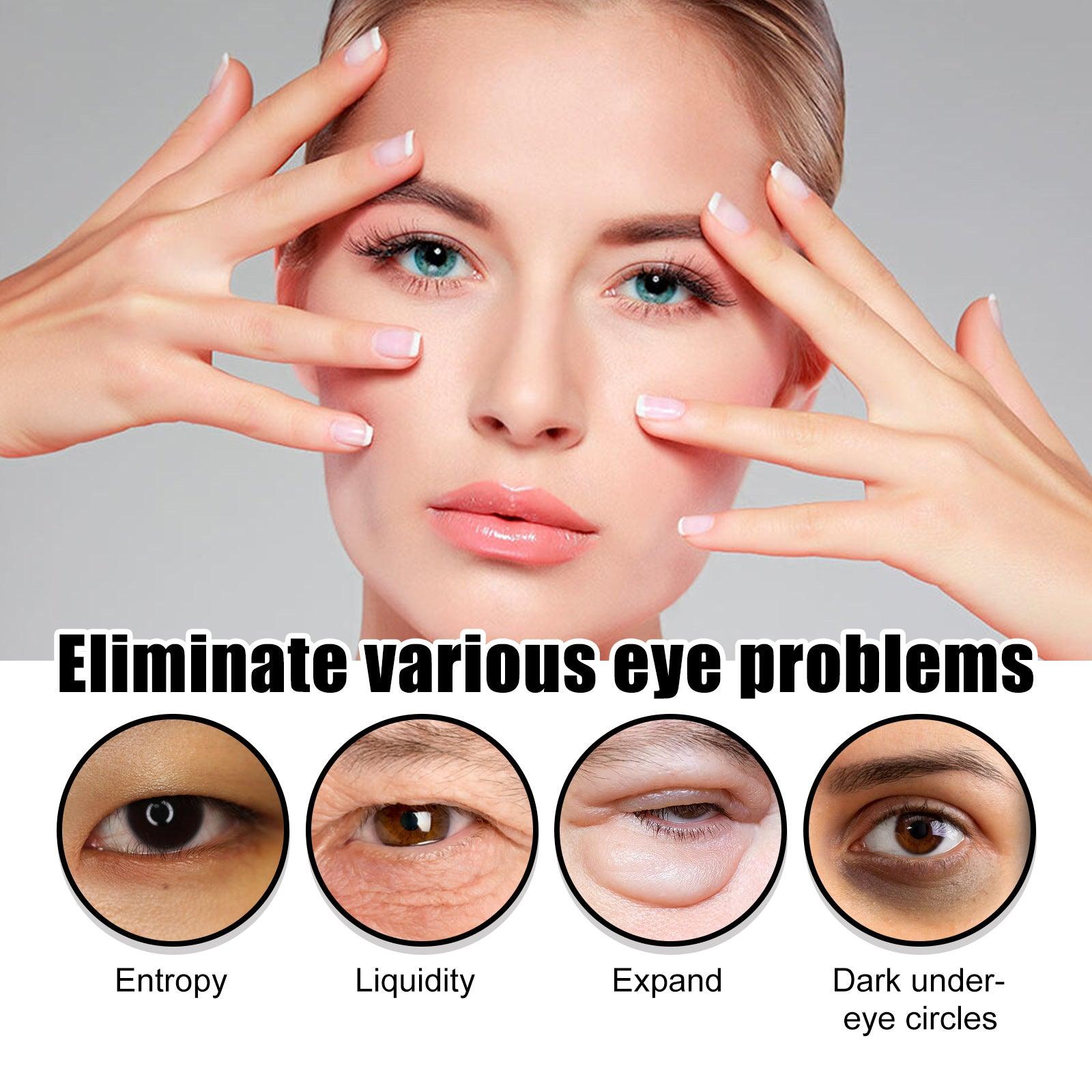 Snake Venom Eye Cream Kojic Acid Coffee Seed Extract Hyaluronic Acid Dark Circles Wrinkles Tightening