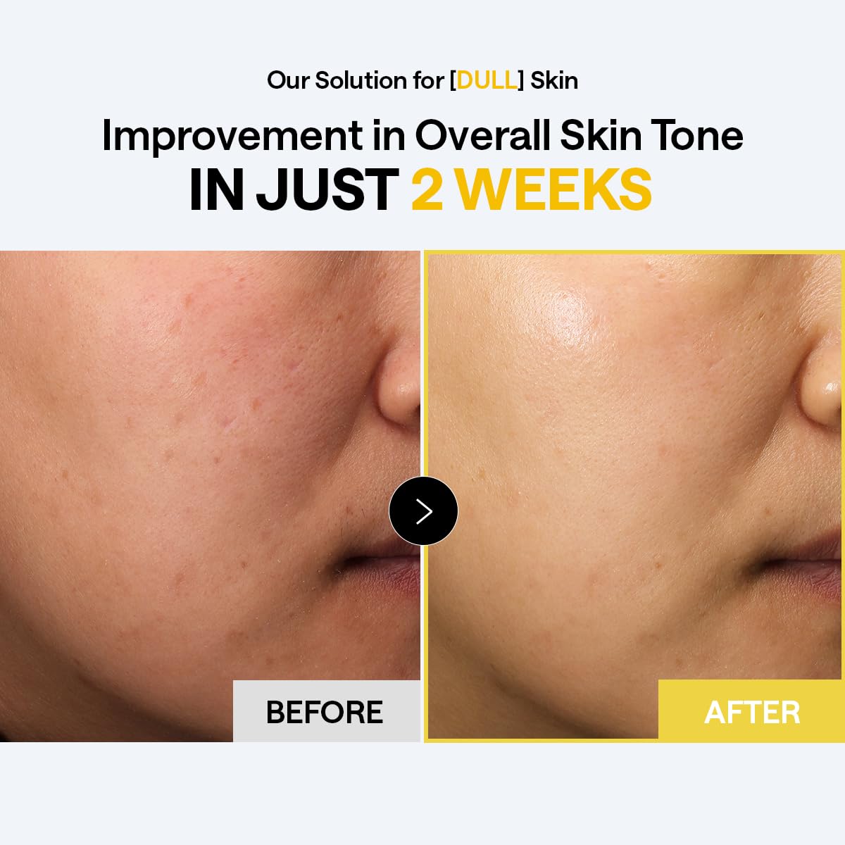 MEDIHEAL Vitamin C Brightening Toner Pads – Korean Skincare, 99% Pure Encapsulated Vitamin C with Sea Buckthorn & Glutathione, Dark Spots, Uneven Skin Tone Care, Gauze Fabric, 100 Pads 🍁 All In One Marketplace Canada