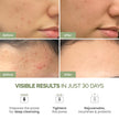 PLANTIFIQUE Clay Mask with Avocado & Superfoods - Korean Face Masks Skincare Products - Dermatologically Tested - Masque Visage Beauté - Gift Idea, 110g / 3.88 fl oz 🍁 All In One Marketplace Canada