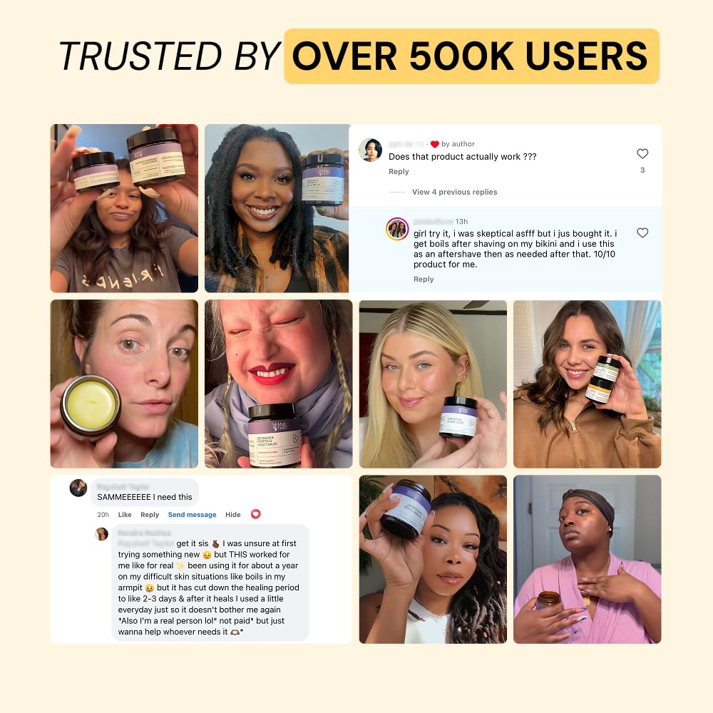 MyMagicHealer Universal Flare Care – Multi-Purpose Solution | Skin Flare-Ups - Hidradenitis Suppurativa, Folliculitis, Boils, Cysts | Anti-Chafing | Irritated Skin Relief w/Propolis & Egg Yolk 28 g 🍁 All In One Marketplace Canada