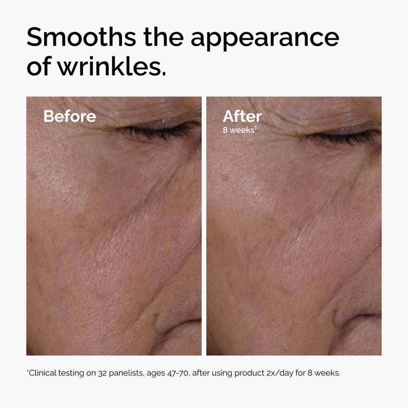 The Ordinary Multi-Peptide + Hyaluronic Acid, Anti-Aging Peptide Serum for Crow’s Feet, Elasticity & Firmness, 30 ml 🍁 All In One Marketplace Canada