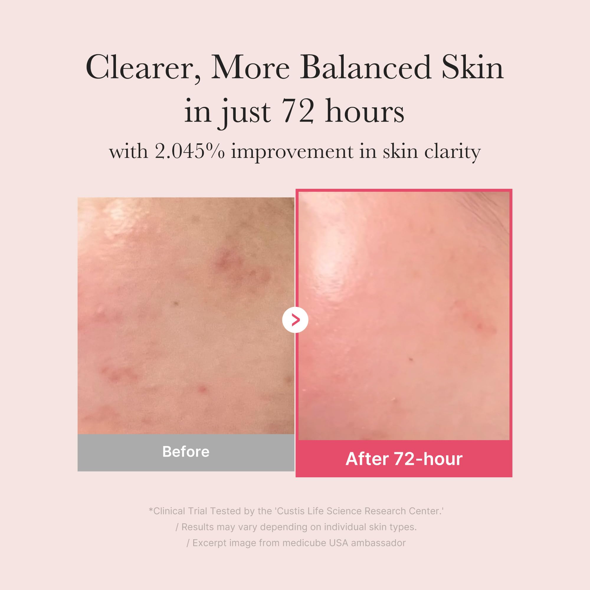medicube TXA+Niacinamide 15% Glow Facial Serum for After Spot Care | All-in-One Daily Korean Skincare | Uneven Skin Tone, Texture, and Hydration Care | High-Potency Tranexamic Acid 5% | 1.01 fl.oz 30ml 🍁 All In One Marketplace Canada
