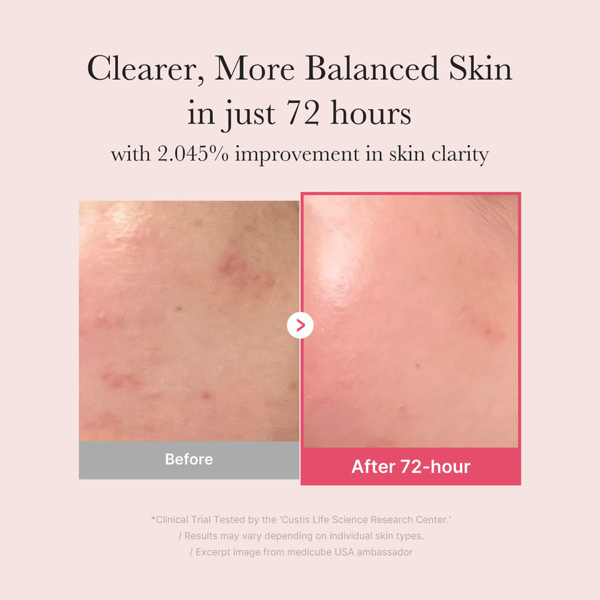 medicube TXA+Niacinamide 15% Glow Facial Serum for After Spot Care | All-in-One Daily Korean Skincare | Uneven Skin Tone, Texture, and Hydration Care | High-Potency Tranexamic Acid 5% | 1.01 fl.oz 30ml 🍁 All In One Marketplace Canada