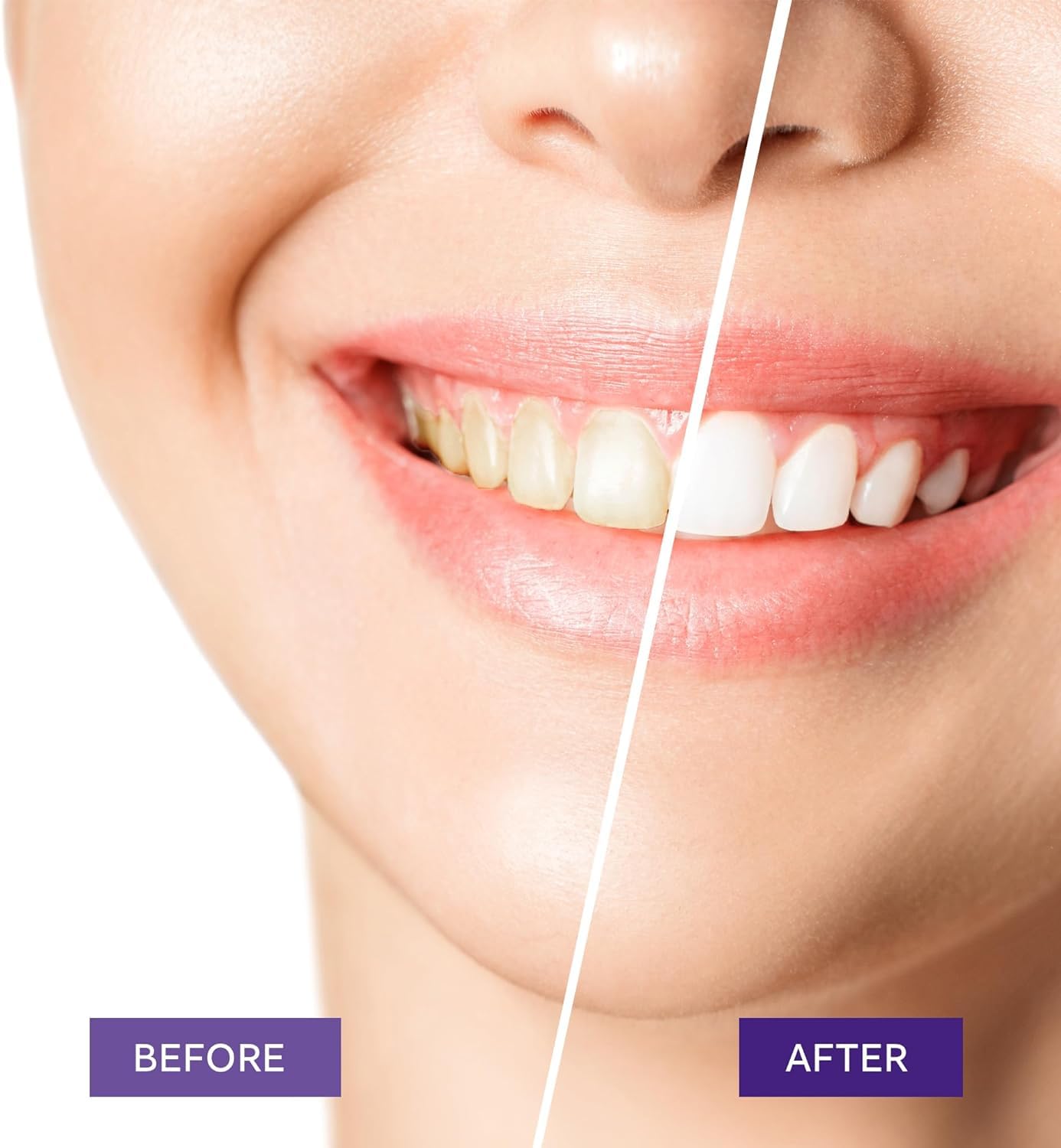 Teeth Whitening Purple Toothpaste- Toothpaste Whitening, Teeth Whitening Toothpaste, Purple Toothpaste Teeth Whitening, Tooth Whitening, Teeth Whitening Gel 30ml 🍁 All In One Marketplace Canada