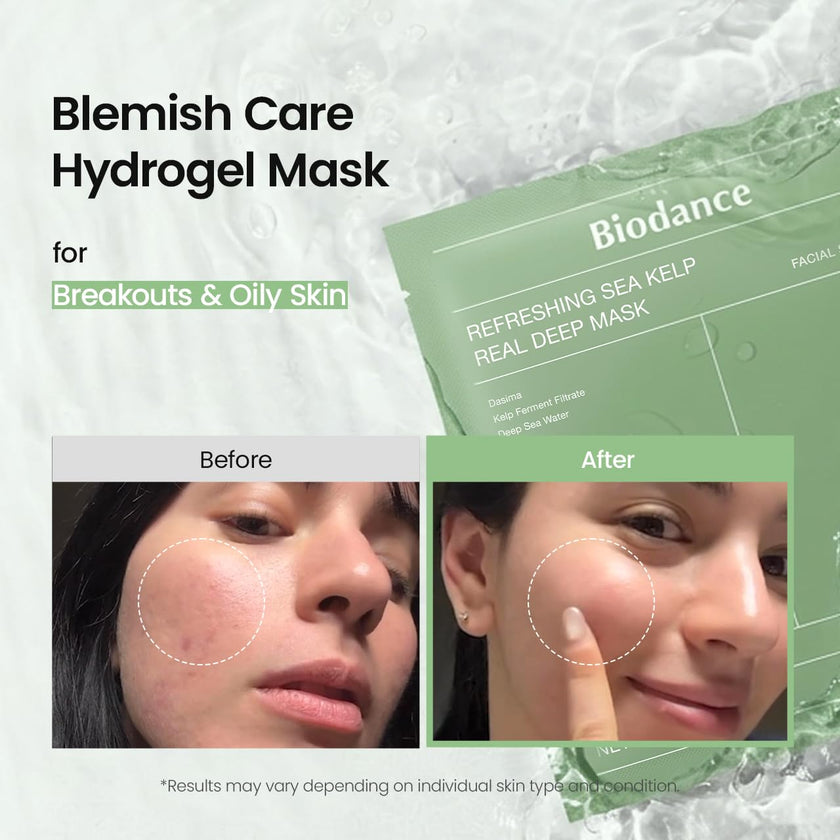 BIODANCE Refreshing Sea kelp Real Deep Mask, Hydrogel Mask, Calming, Oil & Sebum Control, Blemish Care, Korean Skincare, 1.19oz(34g) x 4eaBIODANCE Refreshing Sea kelp Real Deep Mask, Hydrogel Mask, Calming, Oil & Sebum Control, Blemish Care, Korean Skinca
