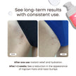 Bushbalm Ingrown Hair 2 Step Routine - Moisturize and Soothe - Ingrown Hair Oil (30 ml), Exfoliating Scrub (236 ml) - Watermelon Sugar - Valued at $49 🍁 All In One Marketplace Canada