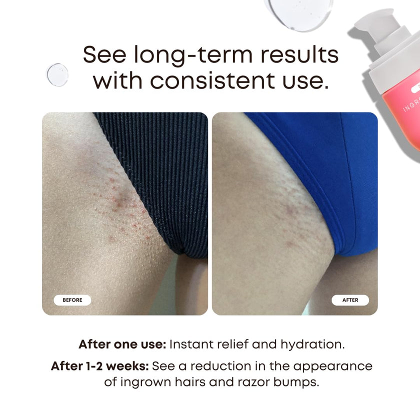 Bushbalm Ingrown Hair 2 Step Routine - Moisturize and Soothe - Ingrown Hair Oil (30 ml), Exfoliating Scrub (236 ml) - Watermelon Sugar - Valued at $49 🍁 All In One Marketplace Canada