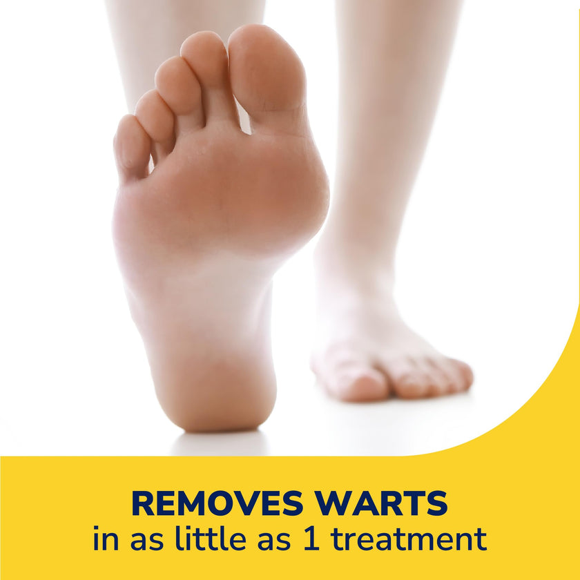 Dr. Scholl’s Dual Action FreezeAway Wart Remover, 12 Treatments. For Common and Plantar Warts, 33 Count (Pack of 1) 🍁 All In One Marketplace Canada