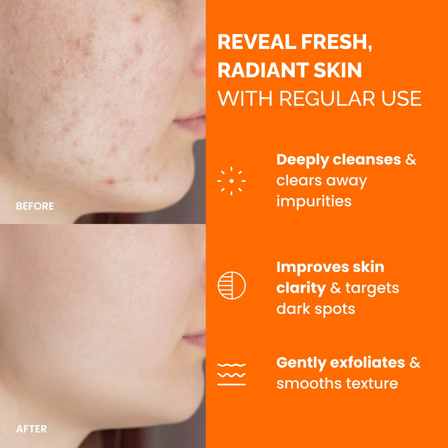 PLANTIFIQUE Kojic Acid and Turmeric Cleansing Pads - Lab-Tested - 60 Exfoliating Pads with Ceramides, Niacinamide & Vitamin C for Dark Spots & Uneven Skin Tone 🍁 All In One Marketplace Canada