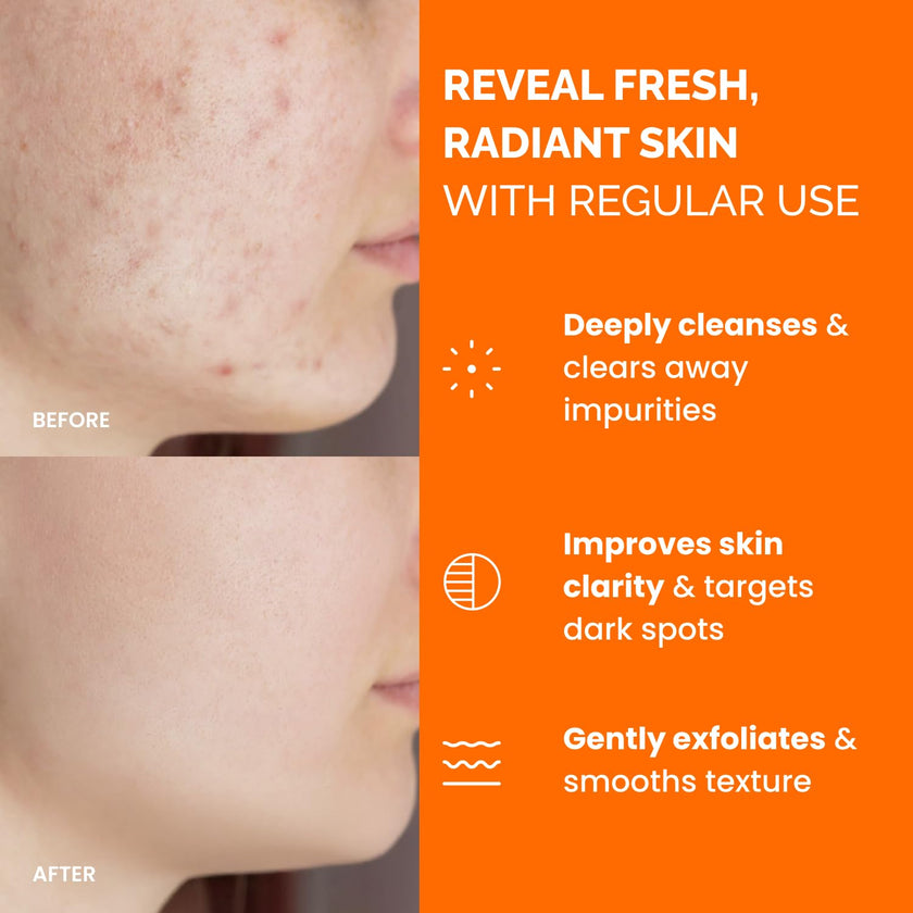 PLANTIFIQUE Kojic Acid and Turmeric Cleansing Pads - Lab-Tested - 60 Exfoliating Pads with Ceramides, Niacinamide & Vitamin C for Dark Spots & Uneven Skin Tone 🍁 All In One Marketplace Canada