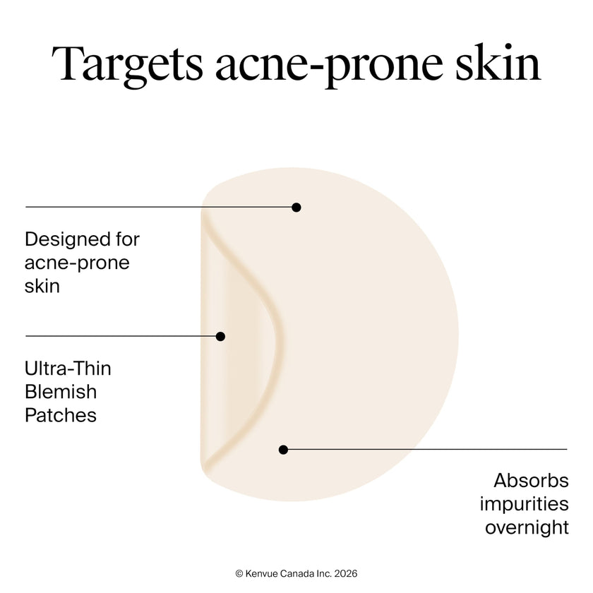 Neutrogena Stubborn Acne Blemish Pimple Patches, Hydrocolloid, 2x24 Pack 🍁 All In One Marketplace Canada