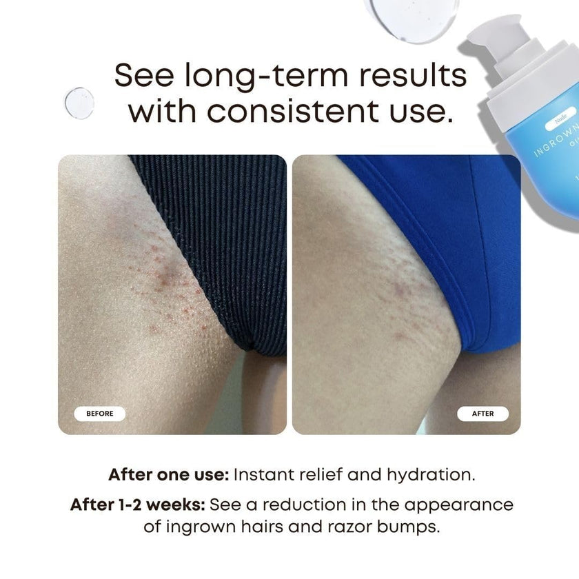 Bushbalm Ingrown Hair Oil - Targets Ingrown Hairs, Razor Bumps and Post Shave Irritation - Soothes and Hydrates Skin, 30 ml - Nude 🍁 All In One Marketplace Canada