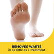 Dr. Scholl’s FreezeAway Wart Remover, 12 Applications // Doctor-Proven Therapy, for Common and Plantar Warts 🍁 All In One Marketplace Canada