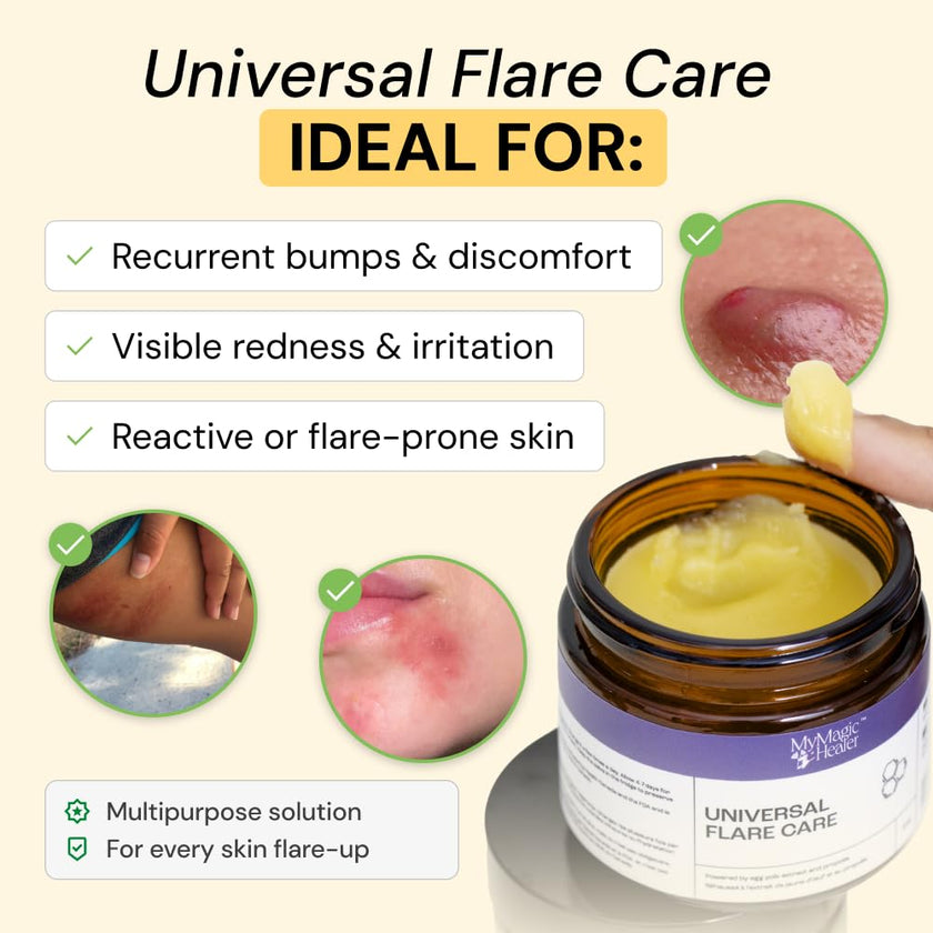 MyMagicHealer Universal Flare Care – Multi-Purpose Solution | Skin Flare-Ups - Hidradenitis Suppurativa, Folliculitis, Boils, Cysts | Anti-Chafing | Irritated Skin Relief w/Propolis & Egg Yolk 28 g 🍁 All In One Marketplace Canada