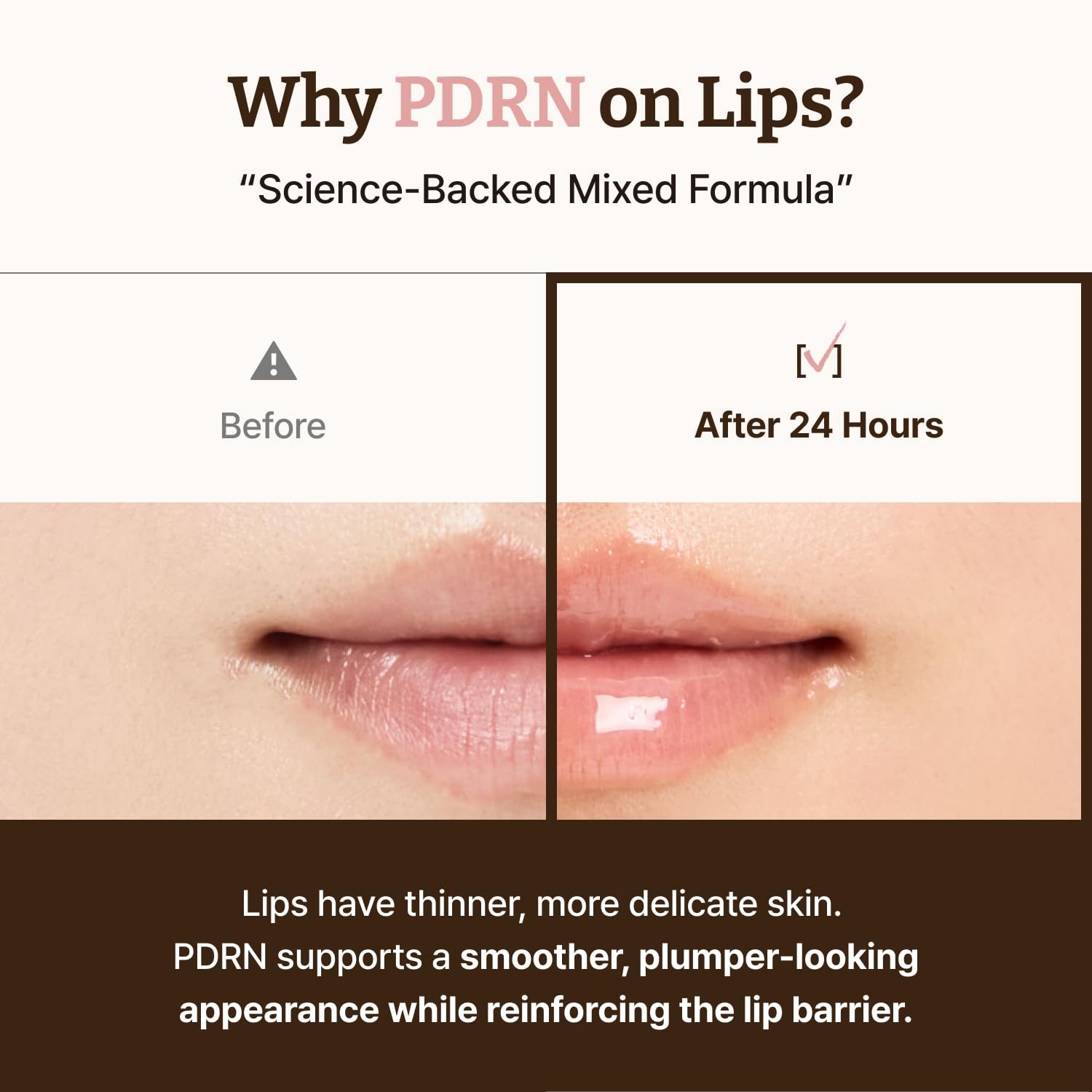 Dr. Reju-All Advanced PDRN Rejuvenating Lip Serum - Hydrating Lip Balm with Lipozip PDRN for Glowy, Dewy Lips - Gentle Exfoliating & Smoothing Lip Moisturizer - Hibiscus & Lactic Acid - 10ml 🍁 All In One Marketplace Canada