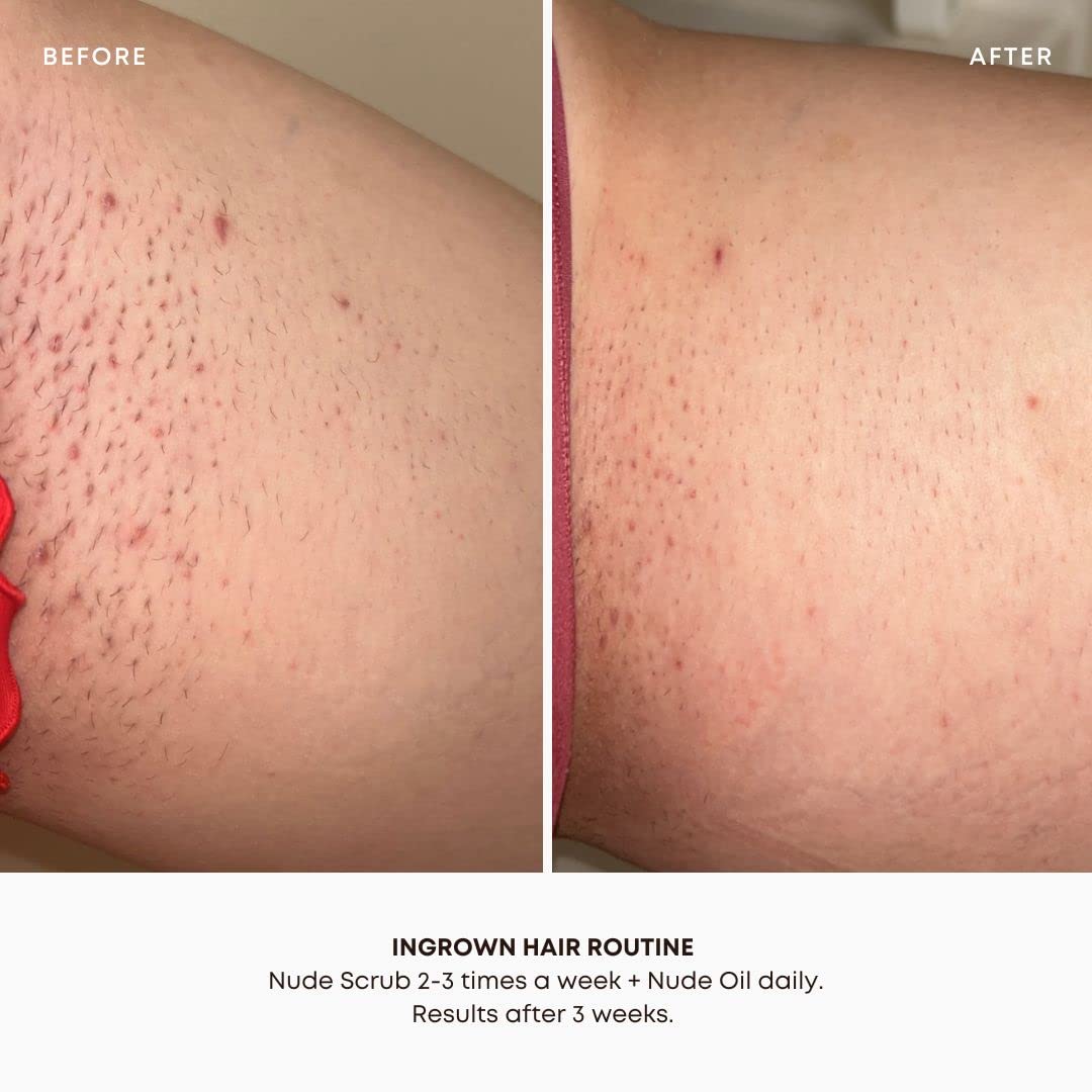 Bushbalm Ingrown Hair and Razor Bumps 2 Step Routine - Moisturize and Soothe - Nude Ingrown Hair Oil (30 ml), Nude Exfoliating Scrub (236 ml) - Nude - Valued at $49 🍁 All In One Marketplace Canada