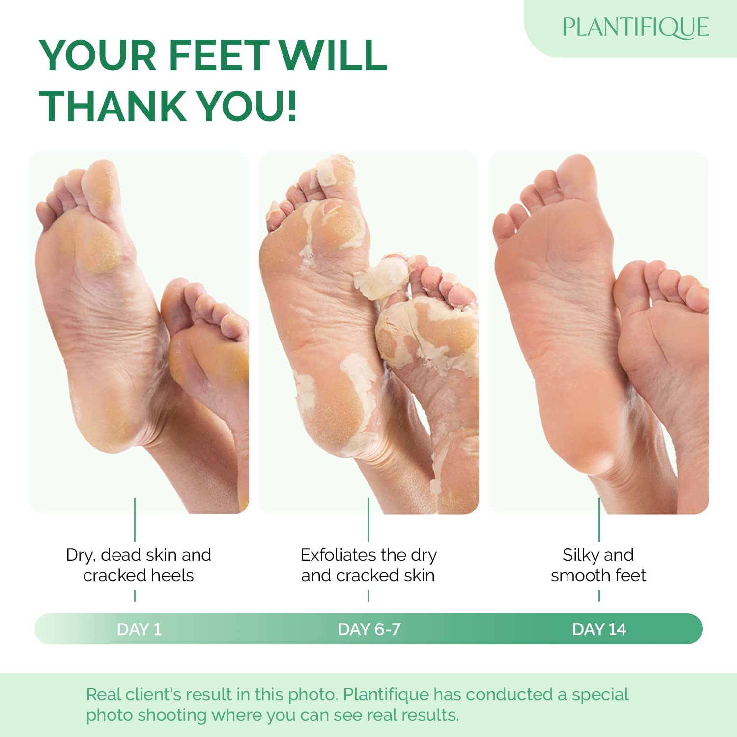 PLANTIFIQUE Foot Peel Mask Dermatologically Tested - 2 Pairs Peach Exfoliating Mask for Dry Cracked Feet - Masque Pied Peeling - Foot Care for Soft Baby Feet 🍁 All In One Marketplace Canada