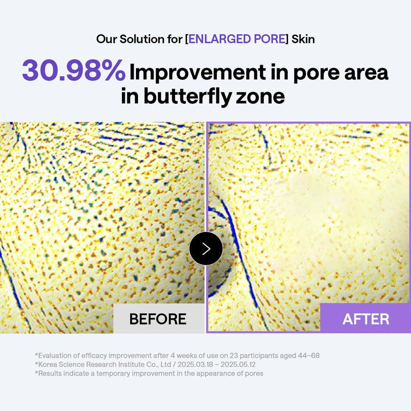 MEDIHEAL PDRN Lifting Toner Pads – Pore Tightening with Plant-Based PDRN, Peptide, Glutathione & PHA, Pore Care, Firming & Wrinkle Care, Stretchy Lifting Fabric, Korean Skin Care, 100 Pads 🍁 All In One Marketplace Canada