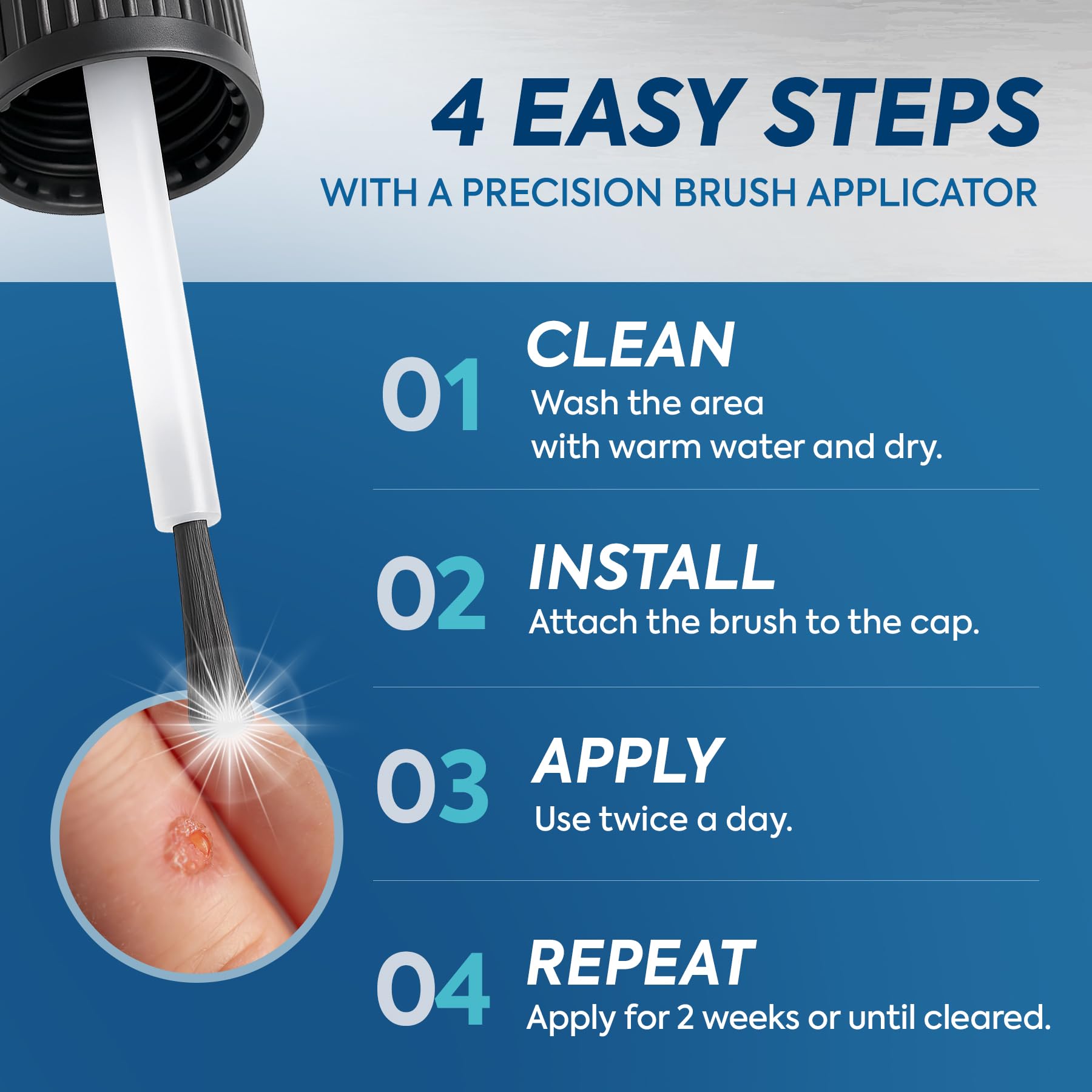 Fast-Acting Wart Corn Remover: Salicylic Acid Treatment for Feet Toe - Maximum Strength Liquid for Plantar Wart Corn Removal Men and Women 🍁 All In One Marketplace Canada