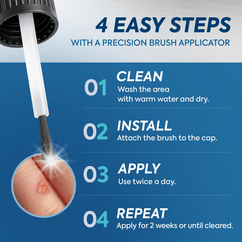 Fast-Acting Wart Corn Remover: Salicylic Acid Treatment for Feet Toe - Maximum Strength Liquid for Plantar Wart Corn Removal Men and Women 🍁 All In One Marketplace Canada