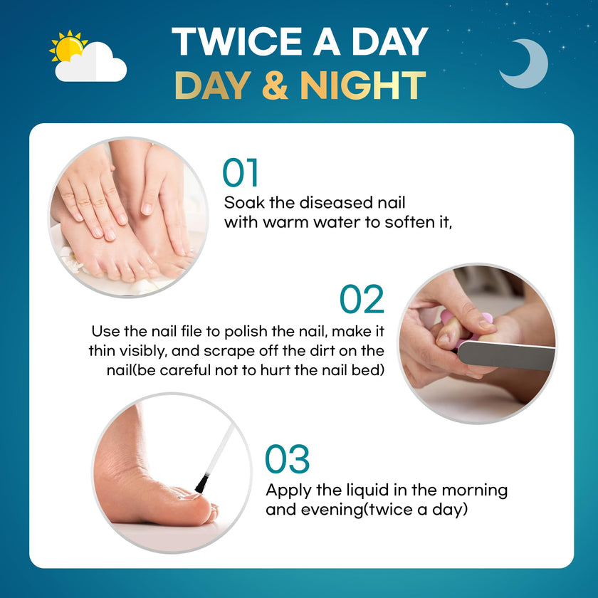 Tobcharm Nail Fungus Treatment for Toenails, Toe Nail Fungus Treatment, Nail Fungus Treatment, Toenail Fungus Treatment, Toe Fungus Treatment Extra Strength, Fungus Nail Killer, Nail Antifungal, Fungal Nail Treatment for Fingernails (30ml)
