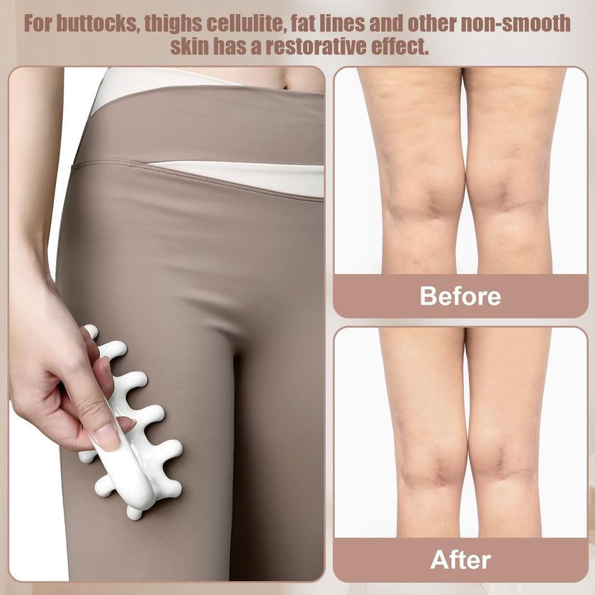 VEMOKY Fascia Massage Tool Trigger Point Massage Tools Anti Blaster for Cellulite Massager Tool Reaching Deep Myofascial Tissue Throughout The Body Release Muscle Knot Reduction Cellulite 🍁 All In One Marketplace Canada
