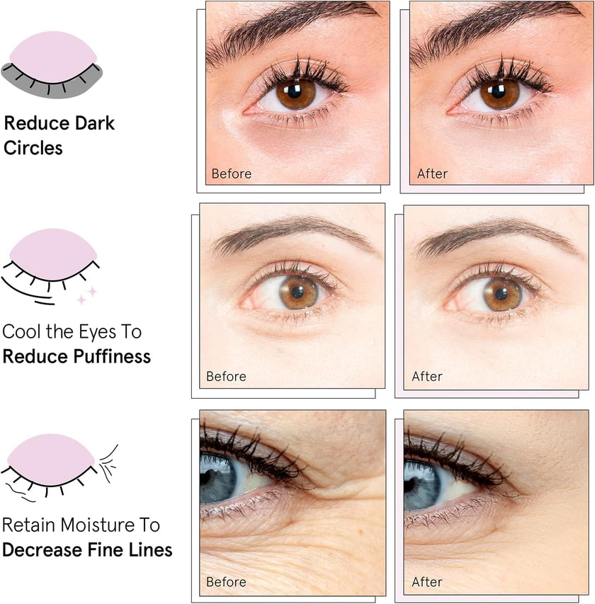 grace & stella Award Winning Under Eye Mask - Gifts for Her - Reduce Dark Circles, Puffy Eyes, Undereye Bags, Wrinkles - Gel Under Eye Patches, Vegan Cruelty-Free Self Care (24 Pairs, Blue) 🍁 All In One Marketplace Canada