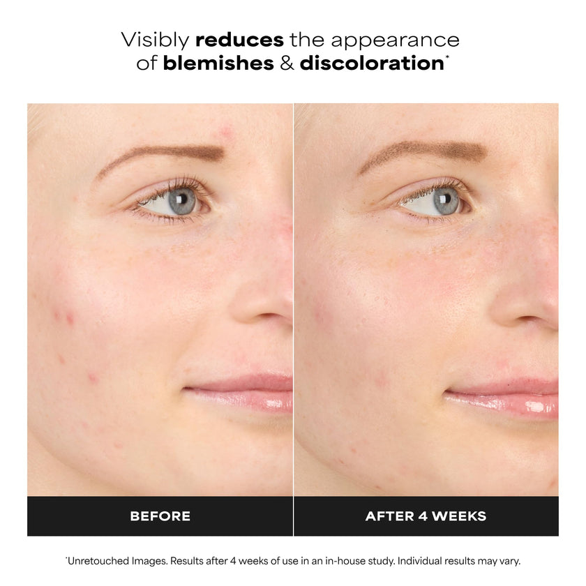 Paula's Choice BOOST 10% Azelaic Acid Booster Cream Gel, Licorice Extract & Salicylic Acid, Oil-Free Skin Serum, Fragrance-Free, 30 ml 🍁 All In One Marketplace Canada