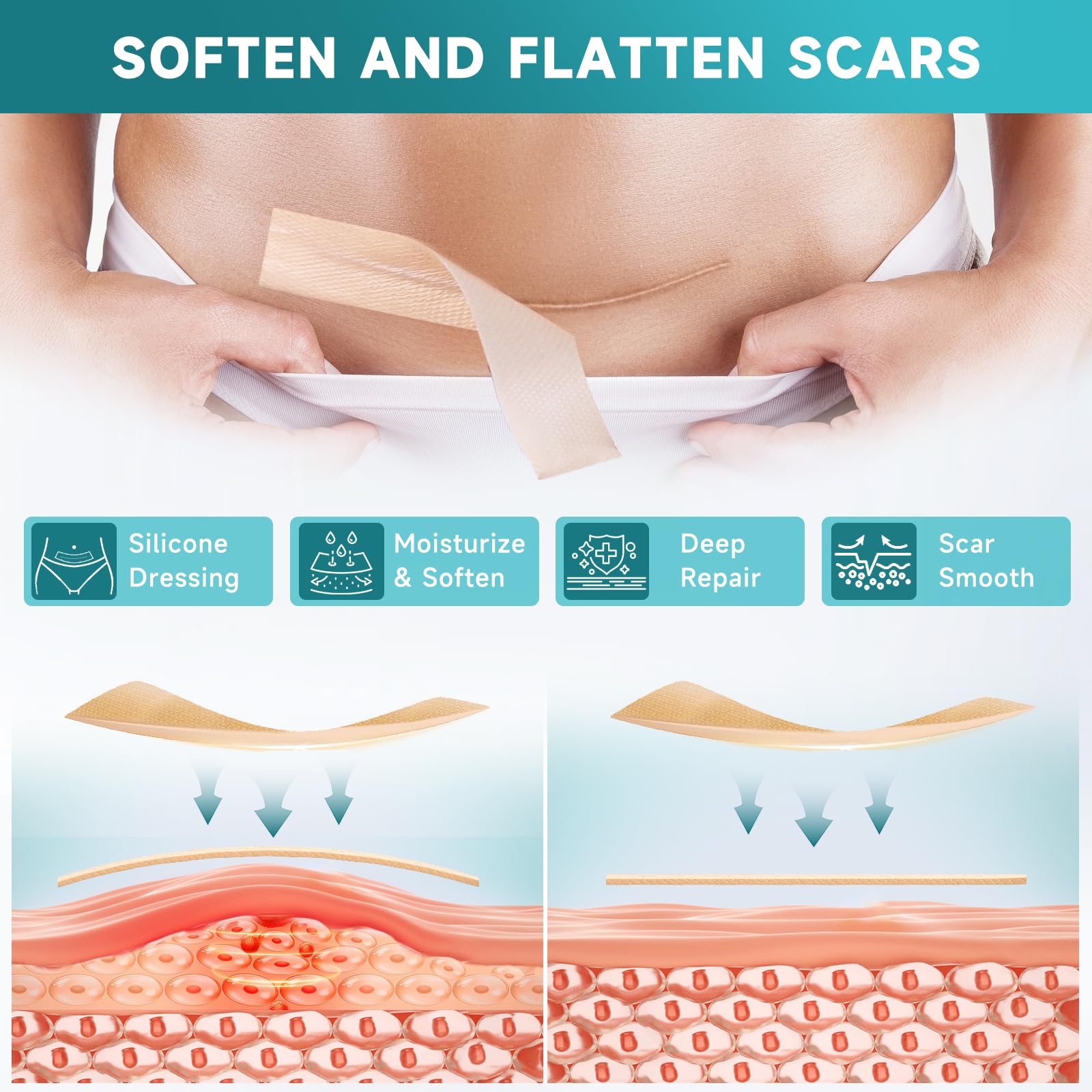 Pumkot Silicone Scar Sheets, Silicone Scar Tape(1.6” x 120” Roll-3M) 🍁 All In One Marketplace Canada