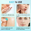 320 PCS Pimple Patch Star Invisible Ultra Thin Star-shaped Pimple Patches Colorful Hydrocolloid Patch Skin Care for Face 🍁 All In One Marketplace Canada