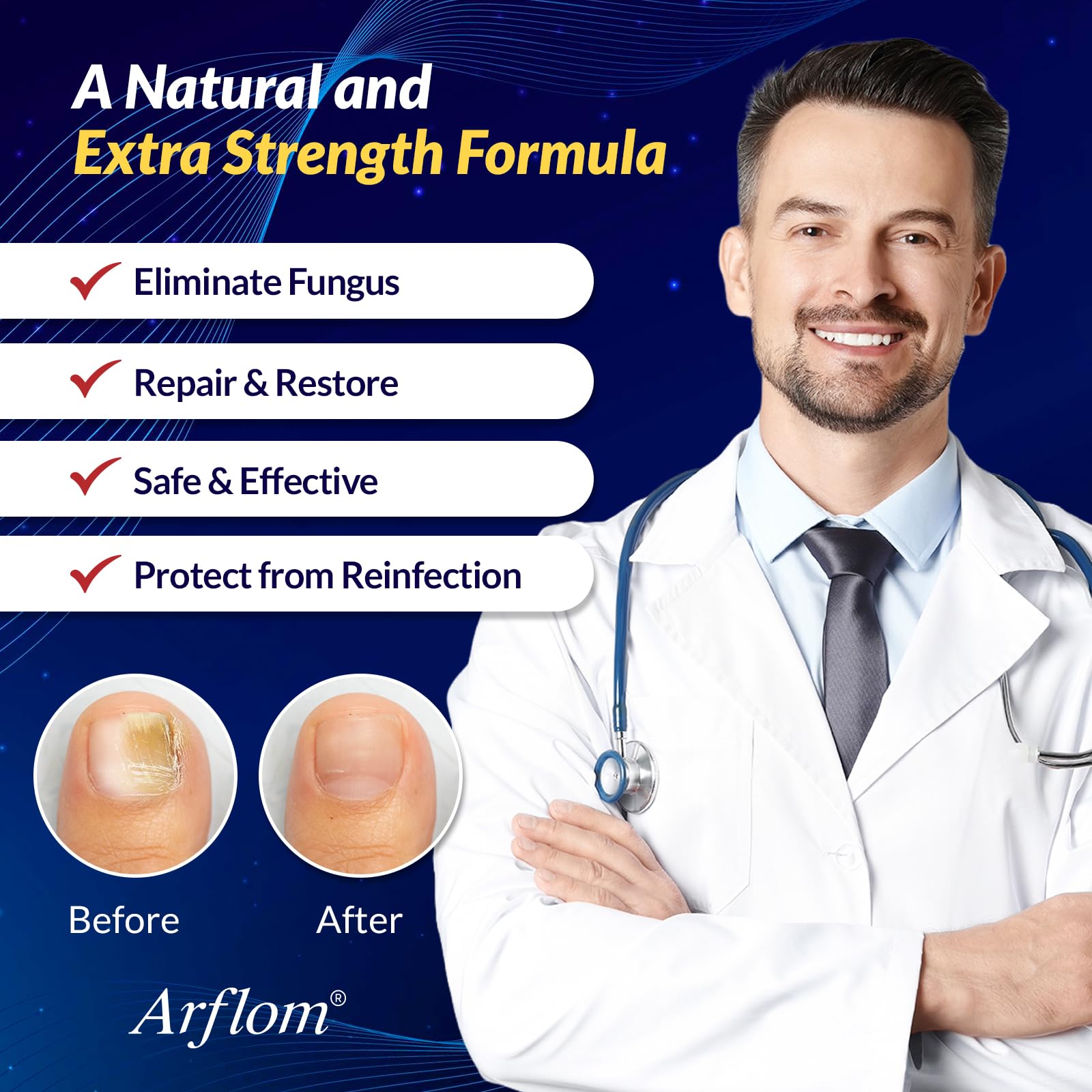 Arflom Toenail Fungus Treatment : 25% Undecylenic Fungal Nail Treatment Extra Strength - Toe and Fingernail with Tea Tree Oil (2pcs, 15ml each) 🍁 All In One Marketplace Canada