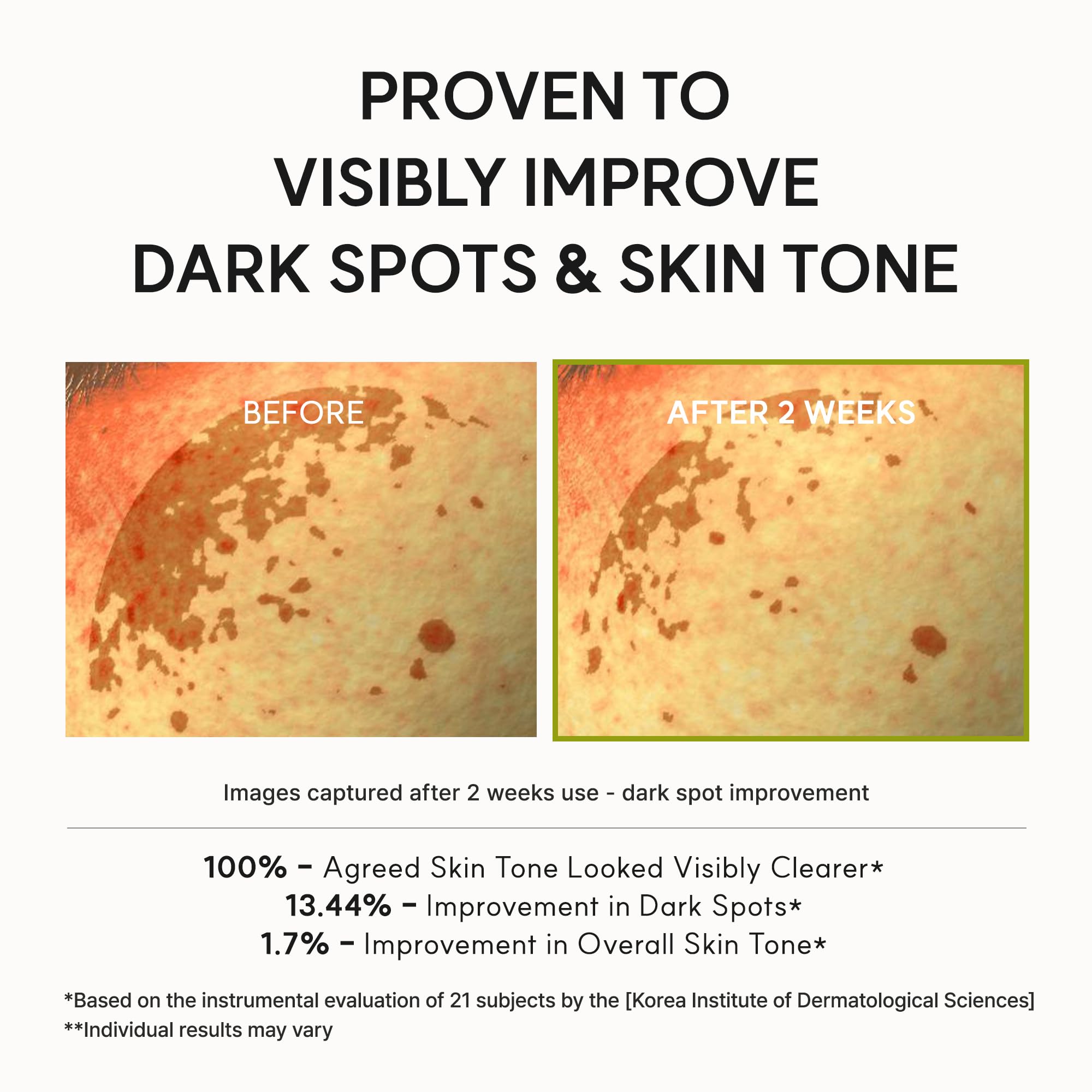 Arencia Vitamin C Booster Shot Serum with Glutathione, Niacinamide and Vitamin E for Dark Spot Care, Fine Lines & Wrinkles, Glass Skin, Korean Skincare 30ml 🍁 All In One Marketplace Canada